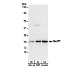 GAMT Antibody, Novus Biologicals 0.1mL; Unlabeled:Antibodies, Polyclonal