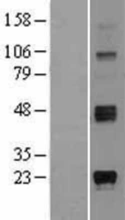 Novus Biologicals&trade;&nbsp;ST8 alpha-2,8-Sialyltransferase 8A/ST8SIA1/Ganglioside GD3 Overexpression Lysate