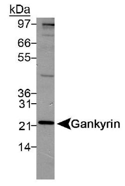 Gankyrin Antibody, Novus Biologicals:Antibodies:Primary Antibodies
