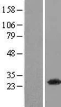 Novus Biologicals&trade;&nbsp;Gankyrin Overexpression Lysate