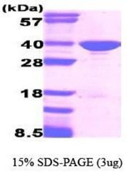 Novus Biologicals™ Recombinant Human GAPDH Protein