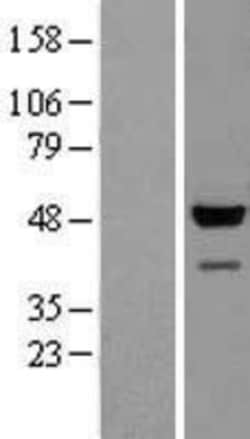 Novus Biologicals&trade;&nbsp;GAPDH-2 Overexpression Lysate