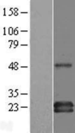 Novus Biologicals&trade;&nbsp;GAPT Overexpression Lysate