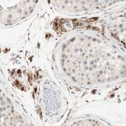 GAPT Antibody, Novus Biologicals 0.1mL; Unlabeled:Antibodies, Polyclonal