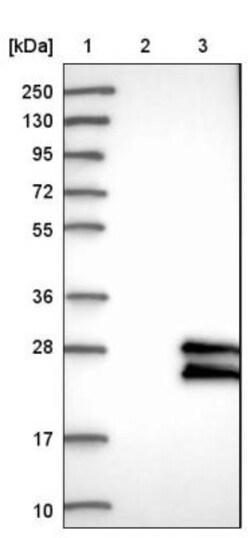 GAPT Antibody, Novus Biologicals 0.1mL; Unlabeled:Antibodies, Polyclonal