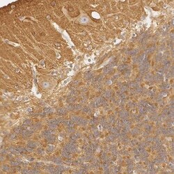 GARNL1 Antibody, Novus Biologicals:Antibodies:Primary Antibodies