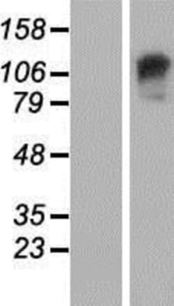 Novus Biologicals&trade;&nbsp;GARNL3 Overexpression Lysate