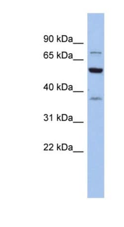GARS Antibody, Novus Biologicals 100μL; Unlabeled:Antibodies, Polyclonal