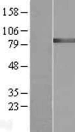 Novus Biologicals&trade;&nbsp;GARS Overexpression Lysate