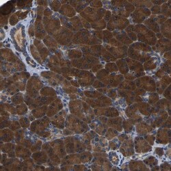 GARS Antibody, Novus Biologicals 0.1mL; Unlabeled:Antibodies, Polyclonal