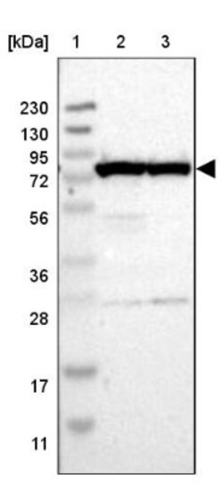 GARS Antibody, Novus Biologicals 0.1mL; Unlabeled:Antibodies, Polyclonal