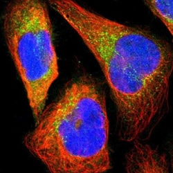 GART Antibody, Novus Biologicals 25 &mu;L | Buy Online | Novus Biologicals | Fisher Scientific