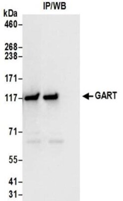 GART Antibody, Novus Biologicals 0.1mg; Unlabeled:Antibodies, Polyclonal