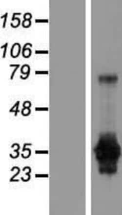 Novus Biologicals&trade;&nbsp;GAS2 Overexpression Lysate