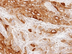 GAS2L1 Antibody, Novus Biologicals 0.1mL; Unlabeled:Antibodies, Polyclonal