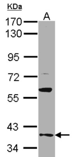 GAS2L1 Antibody, Novus Biologicals 0.1mL; Unlabeled:Antibodies, Polyclonal