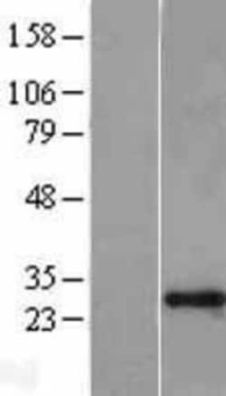Novus Biologicals&trade;&nbsp;GAS41 Overexpression Lysate