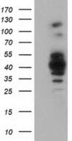 GAS7 Antibody (OTI2F6), Novus Biologicals 0.1 mL | Buy Online | Novus Biologicals | Fisher Scientific