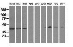 GAS7 Antibody (OTI2F6), Novus Biologicals 0.1 mL | Buy Online | Novus Biologicals | Fisher Scientific