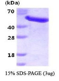 Novus Biologicals&trade;&nbsp;Recombinant Human GAS7 His Protein