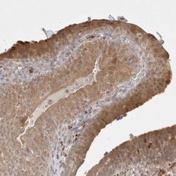 Gasdermin like Antibody, Novus Biologicals 0.1mL; Unlabeled:Antibodies,