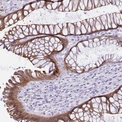 Gasdermin like Antibody, Novus Biologicals:Antibodies:Primary Antibodies