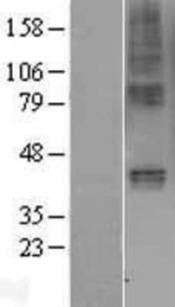 Novus Biologicals™ GIPR Overexpression Lysate