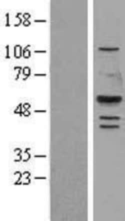 Novus Biologicals&trade;&nbsp;Gastric Lipase Overexpression Lysate