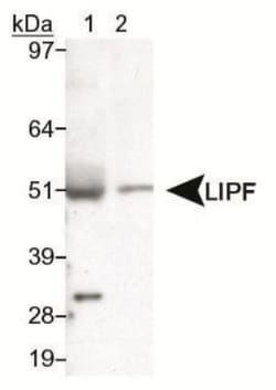 Gastric Lipase Antibody - BSA Free, Novus Biologicals:Antibodies:Primary
