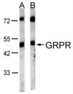 Gastrin-releasing Peptide R/GRPR Antibody, Novus Biologicals 0.1mg; Unlabeled:Antibodies,