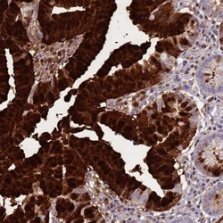 Gastrokine 1 Antibody, Novus Biologicals:Antibodies:Primary Antibodies