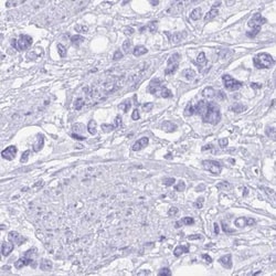 Gastrokine 2 Antibody, Novus Biologicals 0.1mL; Unlabeled:Antibodies, Polyclonal