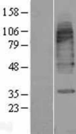 Novus Biologicals&trade;&nbsp;GAT3 Overexpression Lysate