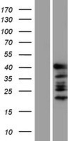 Novus Biologicals&trade;&nbsp;GATA-1 Overexpression Lysate