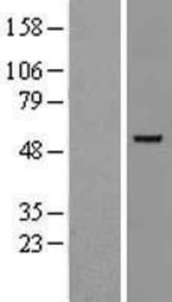 Novus Biologicals&trade;&nbsp;GATA-2 Overexpression Lysate