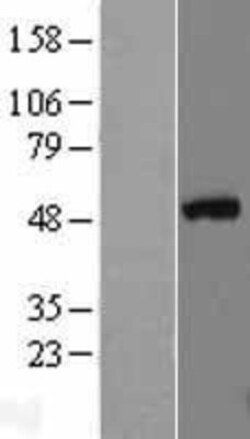 Novus Biologicals&trade;&nbsp;GATA-3 Overexpression Lysate