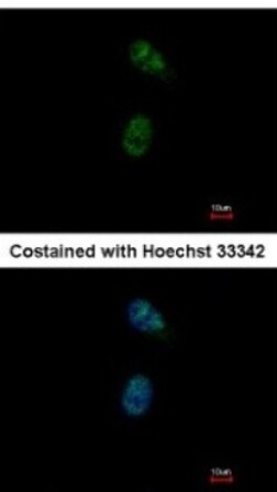 GATA-4 Antibody, Novus Biologicals 0.1mL; Unlabeled:Antibodies, Polyclonal