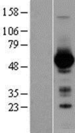 Novus Biologicals™ GATA-4 Overexpression Lysate