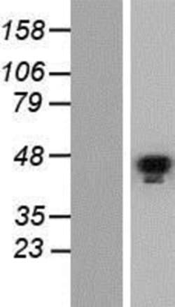 Novus Biologicals™ GATA-5 Overexpression Lysate