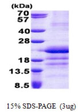 Novus Biologicals&trade;&nbsp;Recombinant Human GATC His Protein