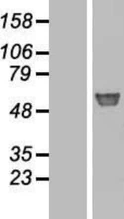 Novus Biologicals&trade;&nbsp;Glucosylceramidase/GBA Overexpression Lysate