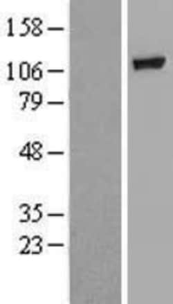 Novus Biologicals&trade;&nbsp;GBA2 Overexpression Lysate