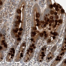 GBA2 Antibody, Novus Biologicals 25 &mu;L | Buy Online | Novus Biologicals | Fisher Scientific