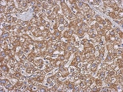 GBAS Antibody, Novus Biologicals 0.1mL; Unlabeled:Antibodies, Polyclonal