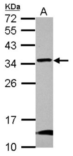GBAS Antibody, Novus Biologicals 0.1mL; Unlabeled:Antibodies, Polyclonal