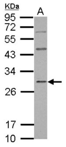 GBAS Antibody, Novus Biologicals 0.1mL; Unlabeled:Antibodies, Polyclonal