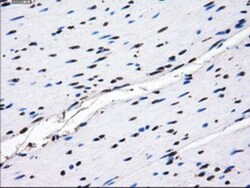 GBE1 Antibody (OTI1D11), Novus Biologicals 0.1mL; Unlabeled:Antibodies,