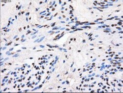 GBE1 Antibody (OTI1D11), Novus Biologicals 0.1mL; Unlabeled:Antibodies,