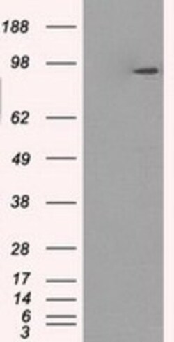 GBE1 Antibody (OTI1D11), Novus Biologicals 0.1mL; Unlabeled:Antibodies,