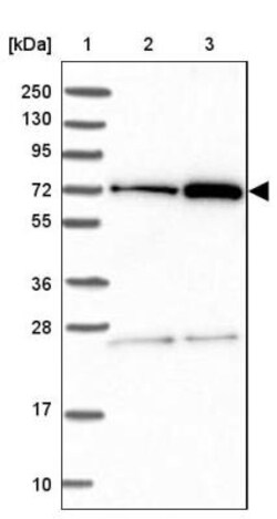 GBE1 Antibody, Novus Biologicals:Antibodies:Primary Antibodies